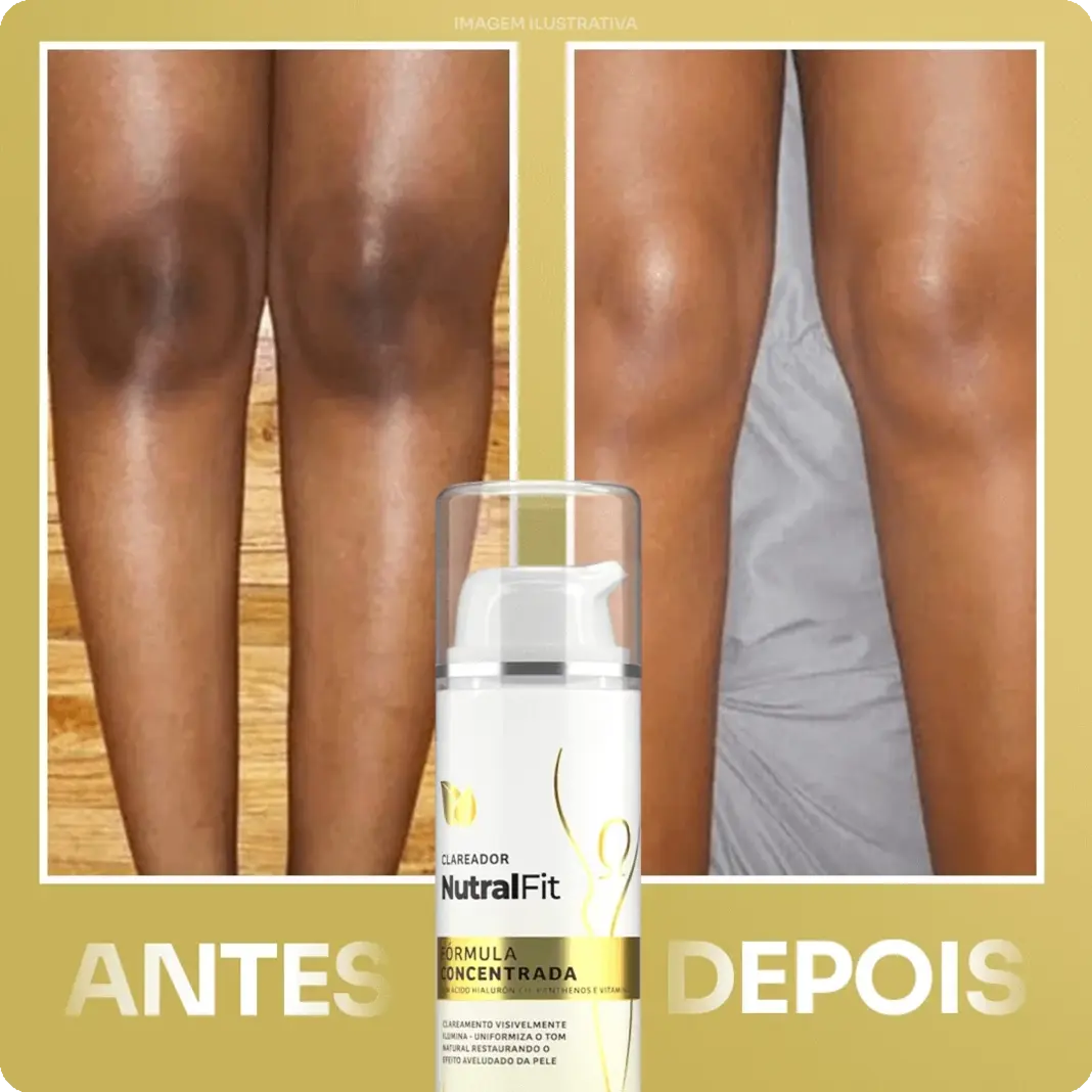 Carrossel Mudanças 1