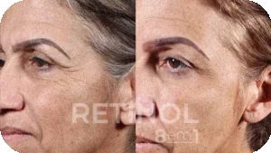 Imagem Retinol 8 em 1 14
