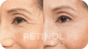 Imagem Retinol 8 em 1 15