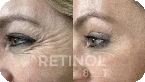 Imagem Retinol 8 em 1 16