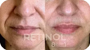 Imagem Retinol 8 em 1 17
